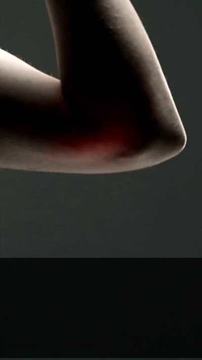 Elbow discomfort
