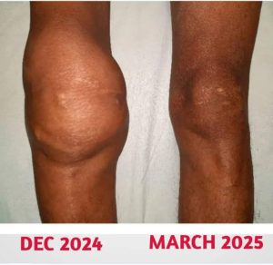 Before using the ointment
