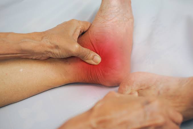 Ankle discomfort